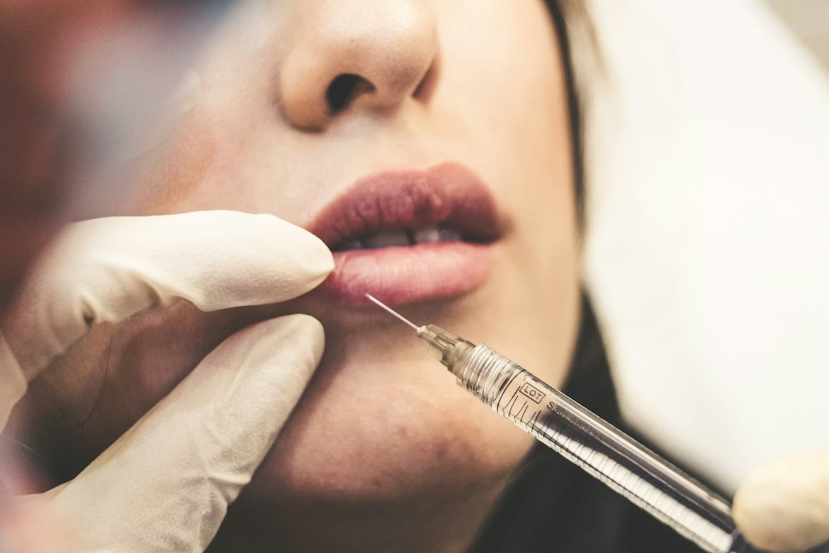 close-up of lip injection cosmetic procedure with syringe and medical gloves